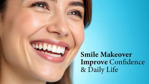 Can a Smile Makeover Improve Confidence and Daily Life?