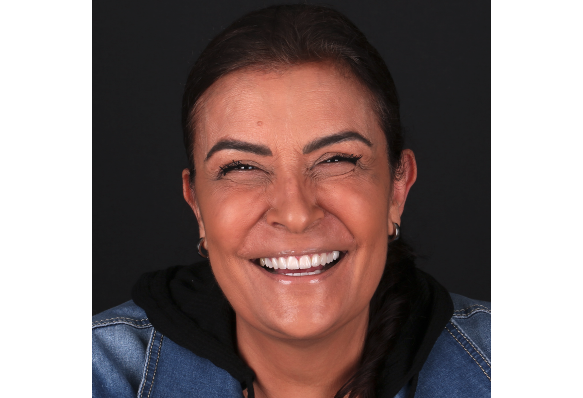 CONNIE
